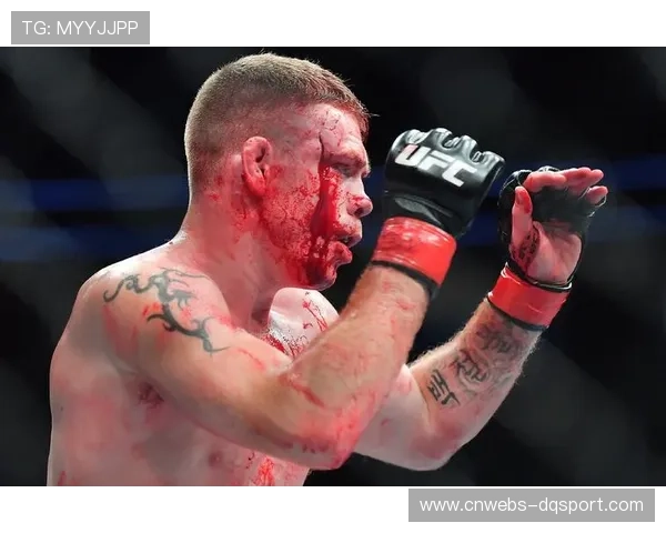 纳干诺减重成效明显，其回归UFC的可能性引发猜测